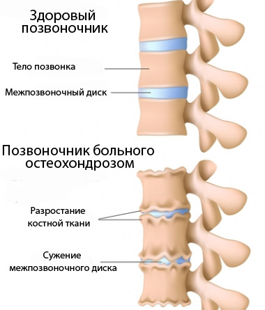 sheinye-pozvonki.jpg
