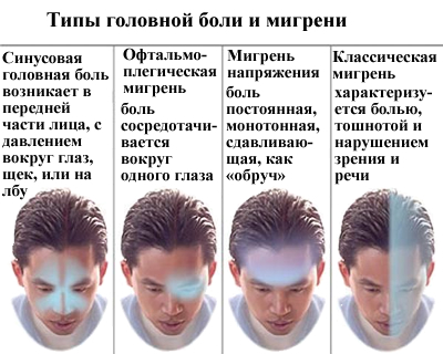 migren2.jpg
